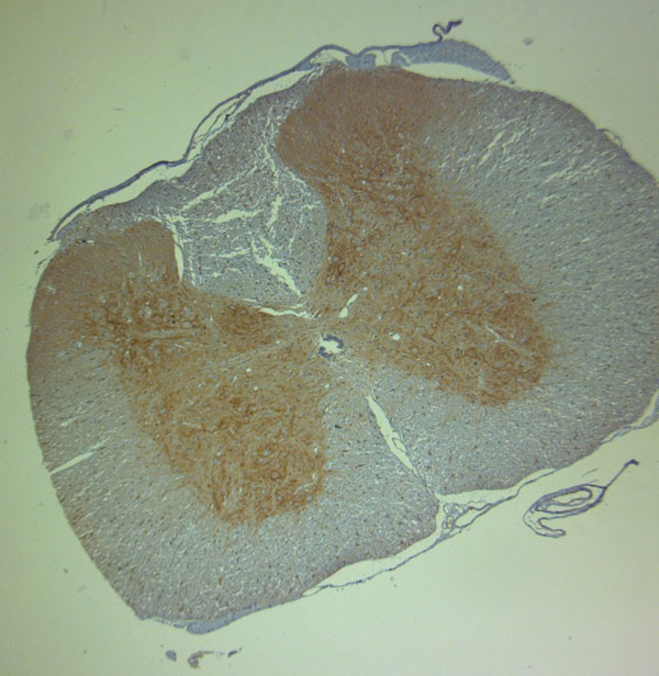 Aggrecan Antibody in Immunohistochemistry (Paraffin) (IHC (P))