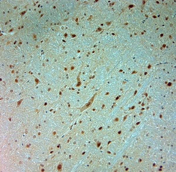 ARX Antibody in Immunohistochemistry (Paraffin) (IHC (P))