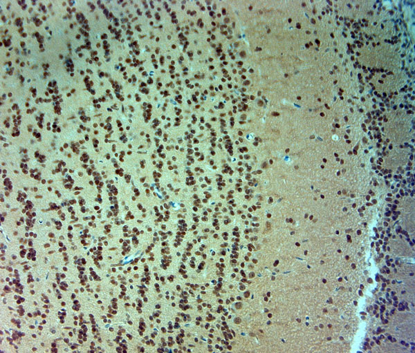 ARX Antibody in Immunohistochemistry (Paraffin) (IHC (P))