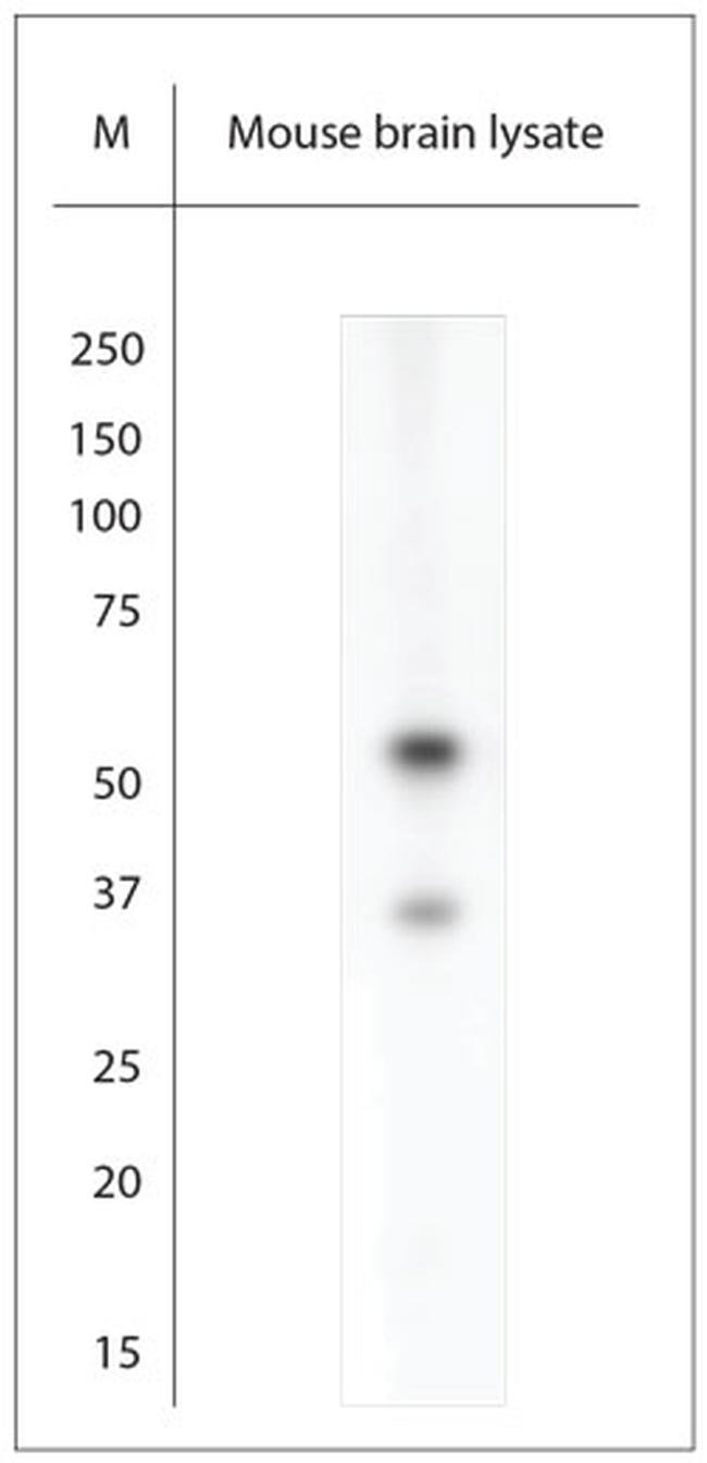 ARX Antibody in Western Blot (WB)