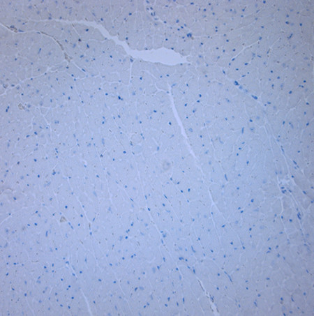 ACE2 Antibody in Immunohistochemistry (Paraffin) (IHC (P))