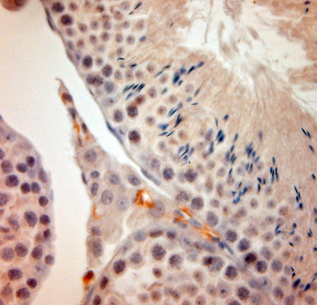 ACE2 Antibody in Immunohistochemistry (Paraffin) (IHC (P))