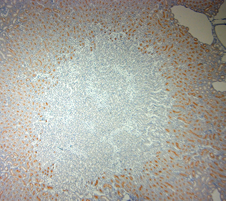 ACE2 Antibody in Immunohistochemistry (Paraffin) (IHC (P))