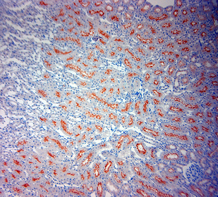 ACE2 Antibody in Immunohistochemistry (Paraffin) (IHC (P))