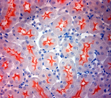 ACE2 Antibody in Immunohistochemistry (Paraffin) (IHC (P))