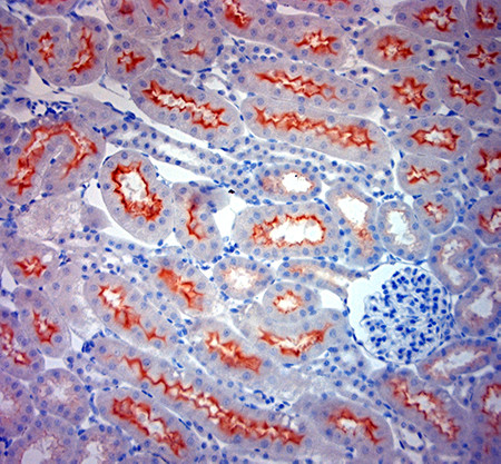 ACE2 Antibody in Immunohistochemistry (Paraffin) (IHC (P))