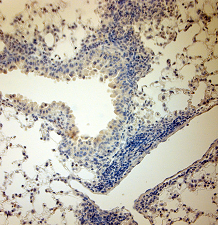 ACE2 Antibody in Immunohistochemistry (Paraffin) (IHC (P))