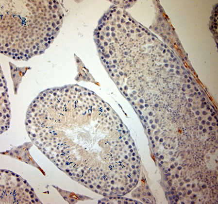 ACE2 Antibody in Immunohistochemistry (Paraffin) (IHC (P))