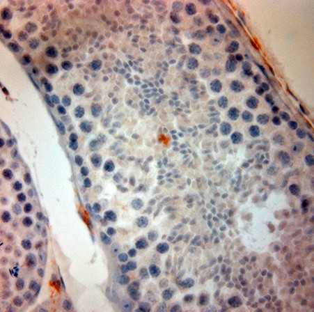 ACE2 Antibody in Immunohistochemistry (Paraffin) (IHC (P))