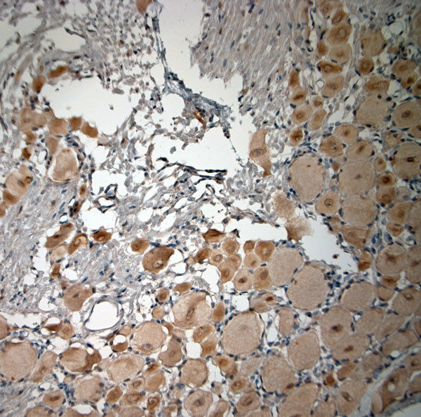 pro BDNF Antibody in Immunohistochemistry (Paraffin) (IHC (P))