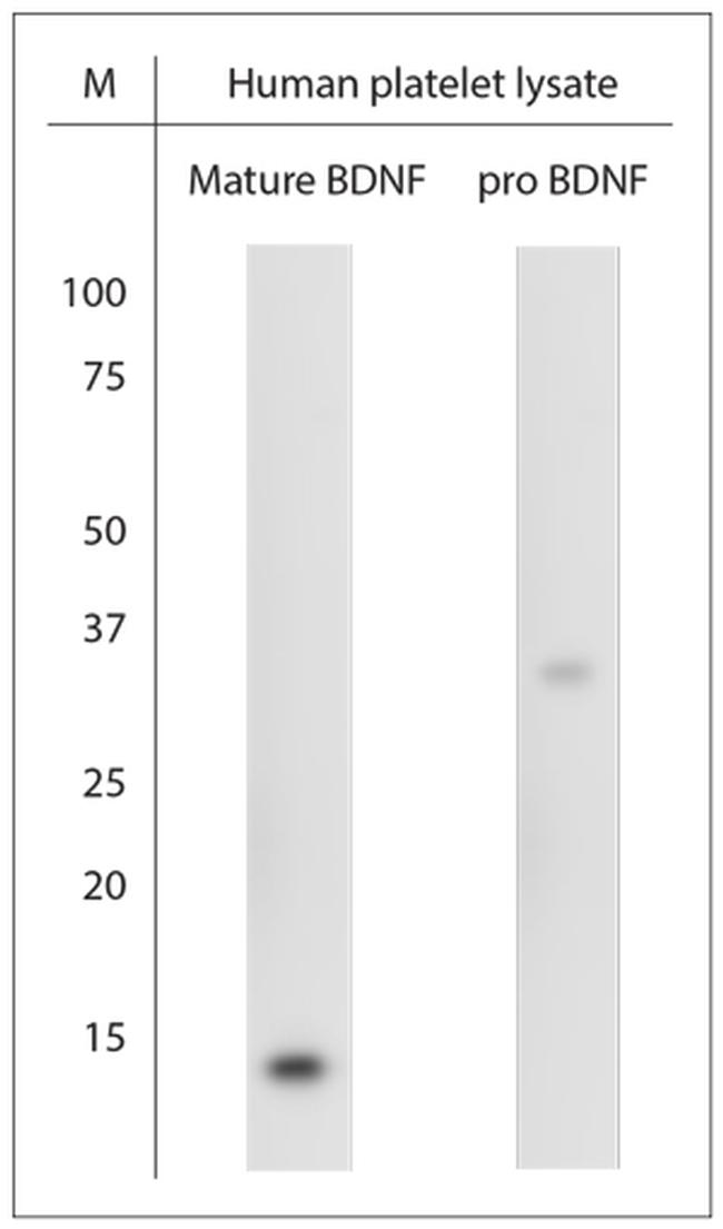 pro BDNF Antibody in Western Blot (WB)