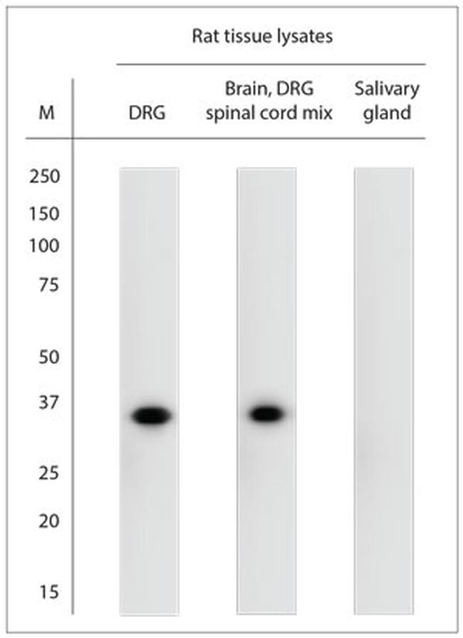 pro BDNF Antibody in Western Blot (WB)