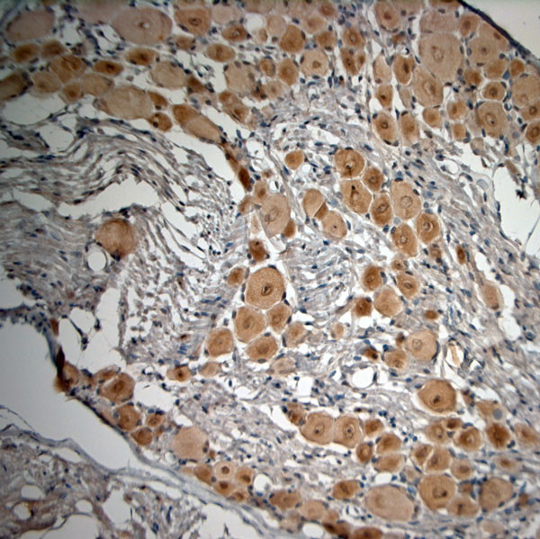 proBDNF Antibody in Immunohistochemistry (Paraffin) (IHC (P))