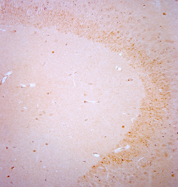 BDNF Antibody in Immunohistochemistry (Paraffin) (IHC (P))