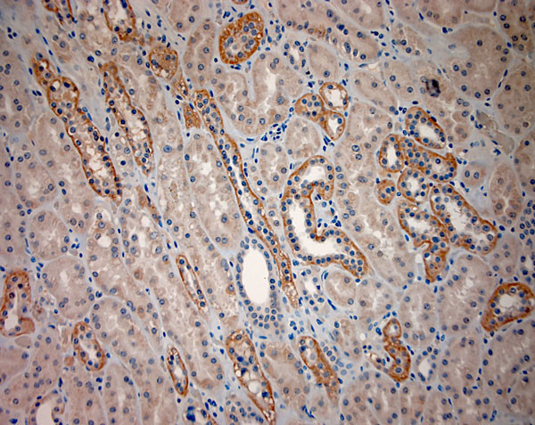 BBS2 Antibody in Immunohistochemistry (Paraffin) (IHC (P))