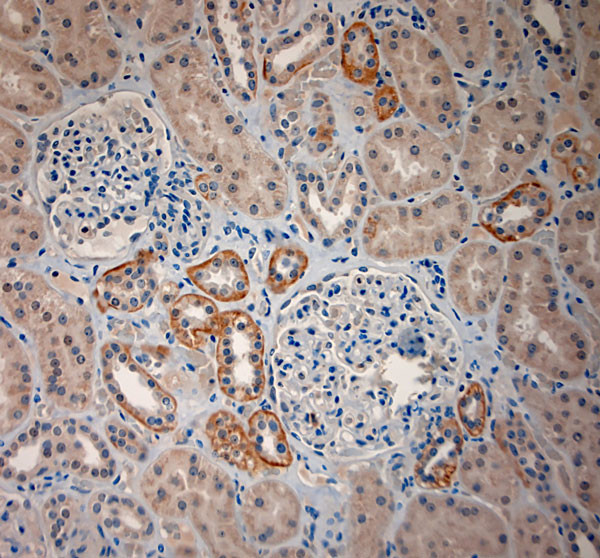 BBS2 Antibody in Immunohistochemistry (Paraffin) (IHC (P))