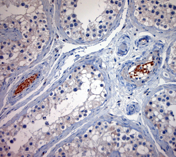 BBS2 Antibody in Immunohistochemistry (Paraffin) (IHC (P))