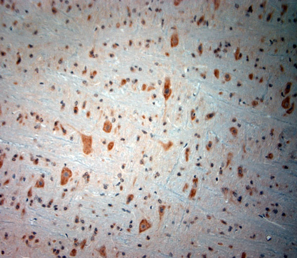 BDKRB2 Antibody in Immunohistochemistry (Paraffin) (IHC (P))