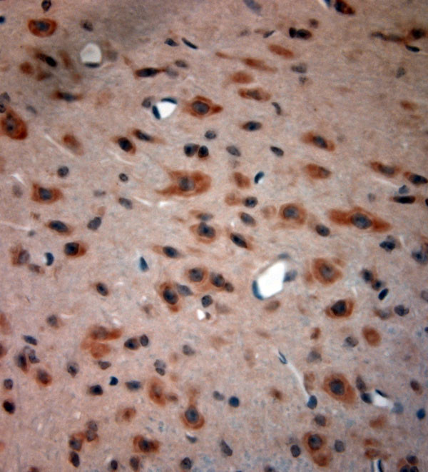 BDKRB2 Antibody in Immunohistochemistry (Paraffin) (IHC (P))