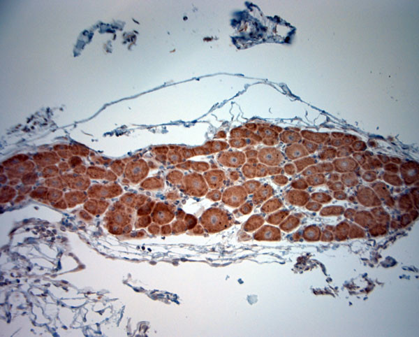 BDKRB2 Antibody in Immunohistochemistry (Paraffin) (IHC (P))