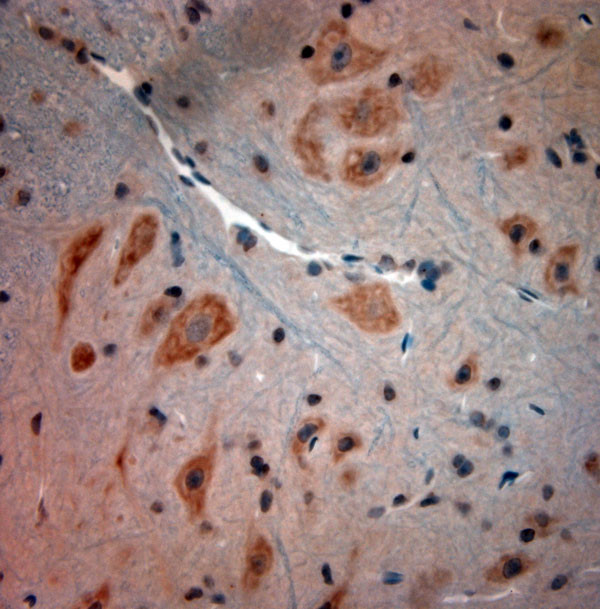 BDKRB2 Antibody in Immunohistochemistry (Paraffin) (IHC (P))