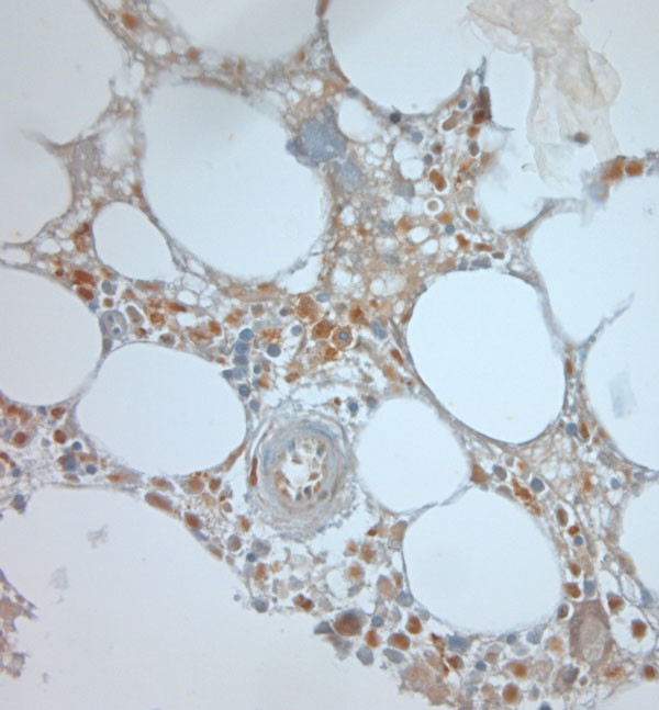 BEX1/BEX2 Antibody in Immunohistochemistry (Paraffin) (IHC (P))