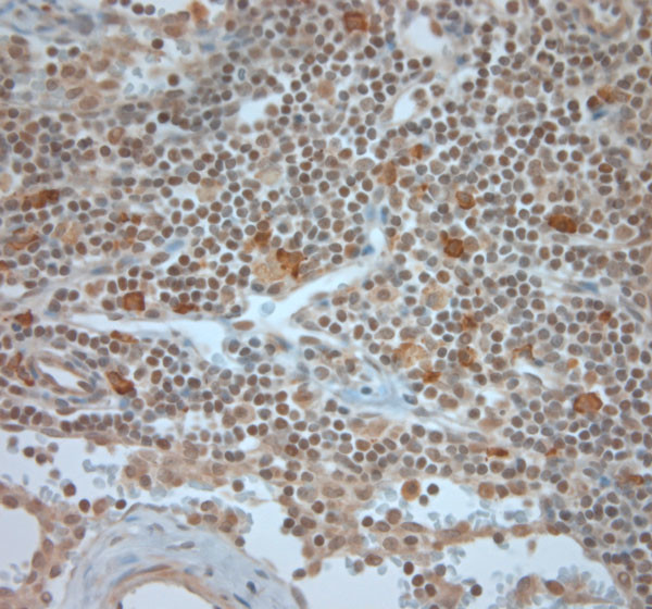 BEX1/BEX2 Antibody in Immunohistochemistry (Paraffin) (IHC (P))