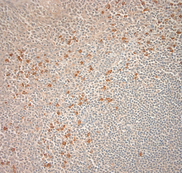 BEX1/BEX2 Antibody in Immunohistochemistry (Paraffin) (IHC (P))