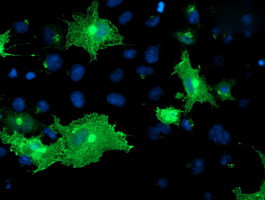 OSBP Antibody in Immunocytochemistry (ICC/IF)