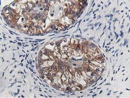 OSBP Antibody in Immunohistochemistry (Paraffin) (IHC (P))