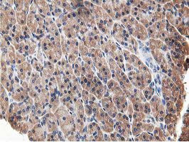 OSBP Antibody in Immunohistochemistry (Paraffin) (IHC (P))