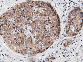 OSBP Antibody in Immunohistochemistry (Paraffin) (IHC (P))