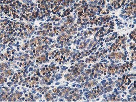 OSBP Antibody in Immunohistochemistry (Paraffin) (IHC (P))