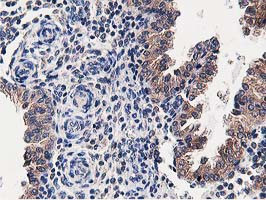 OSBP Antibody in Immunohistochemistry (Paraffin) (IHC (P))