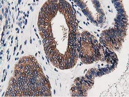 OSBP Antibody in Immunohistochemistry (Paraffin) (IHC (P))