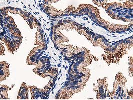 OSBP Antibody in Immunohistochemistry (Paraffin) (IHC (P))