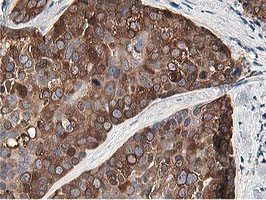 OSBP Antibody in Immunohistochemistry (Paraffin) (IHC (P))