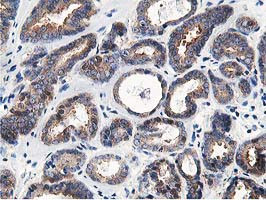 OSBP Antibody in Immunohistochemistry (Paraffin) (IHC (P))