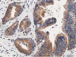 OSBP Antibody in Immunohistochemistry (Paraffin) (IHC (P))