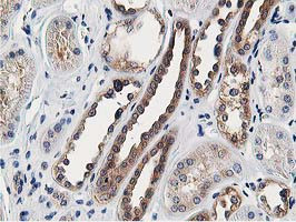 OSBP Antibody in Immunohistochemistry (Paraffin) (IHC (P))