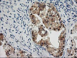 OSBP Antibody in Immunohistochemistry (Paraffin) (IHC (P))