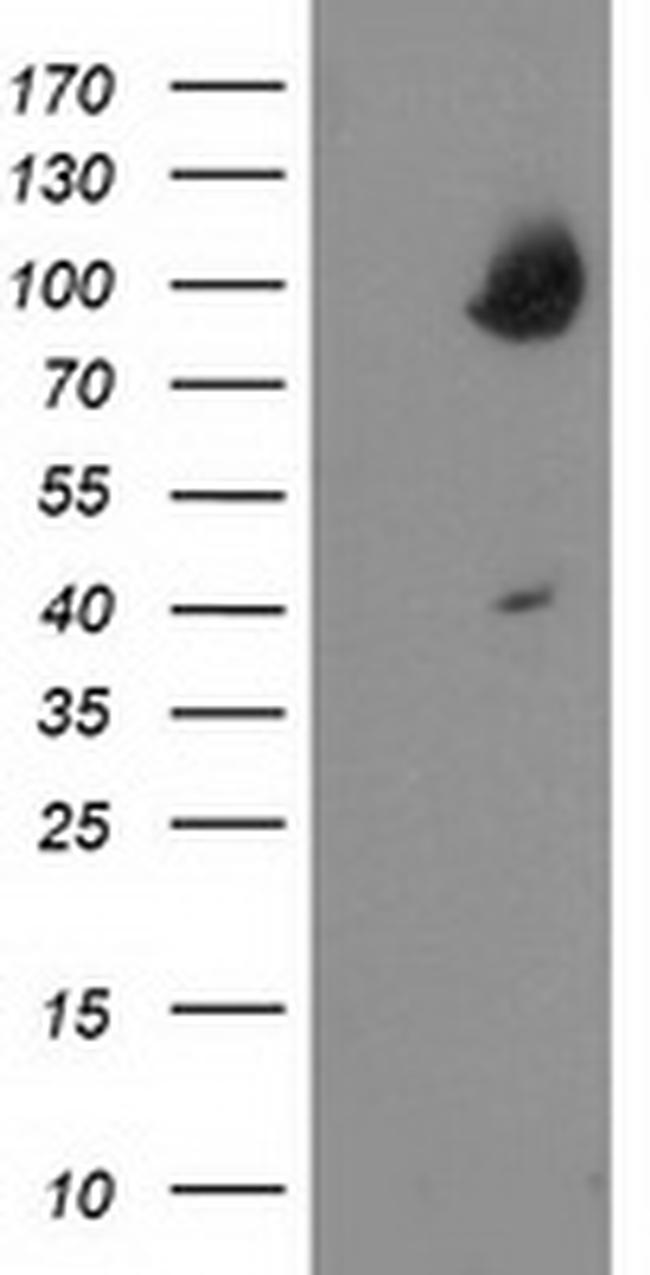 OSBP Antibody in Western Blot (WB)