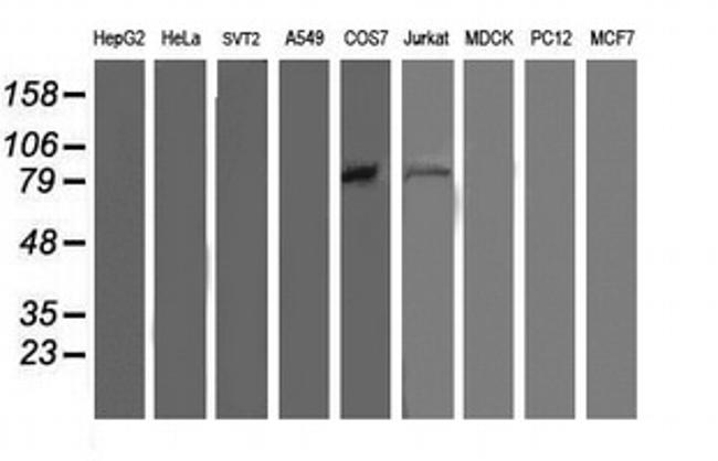 OSBP Antibody in Western Blot (WB)