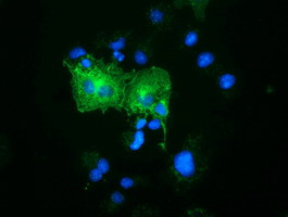 OSBPL11 Antibody in Immunocytochemistry (ICC/IF)