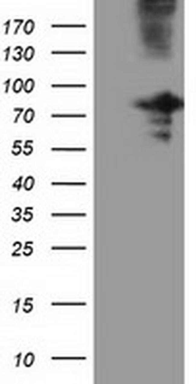 OSBPL11 Antibody in Western Blot (WB)