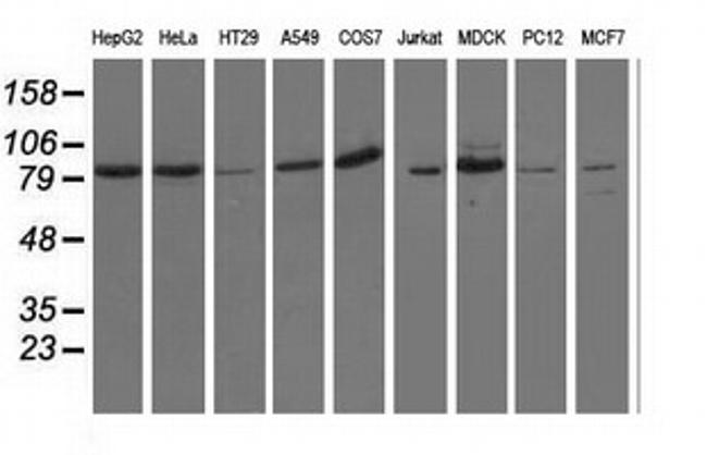 OSBPL11 Antibody in Western Blot (WB)