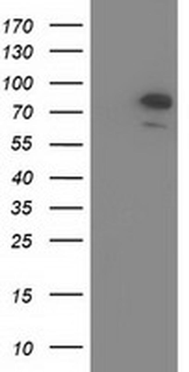 OSBPL11 Antibody in Western Blot (WB)