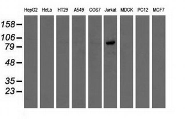 OSBPL11 Antibody in Western Blot (WB)