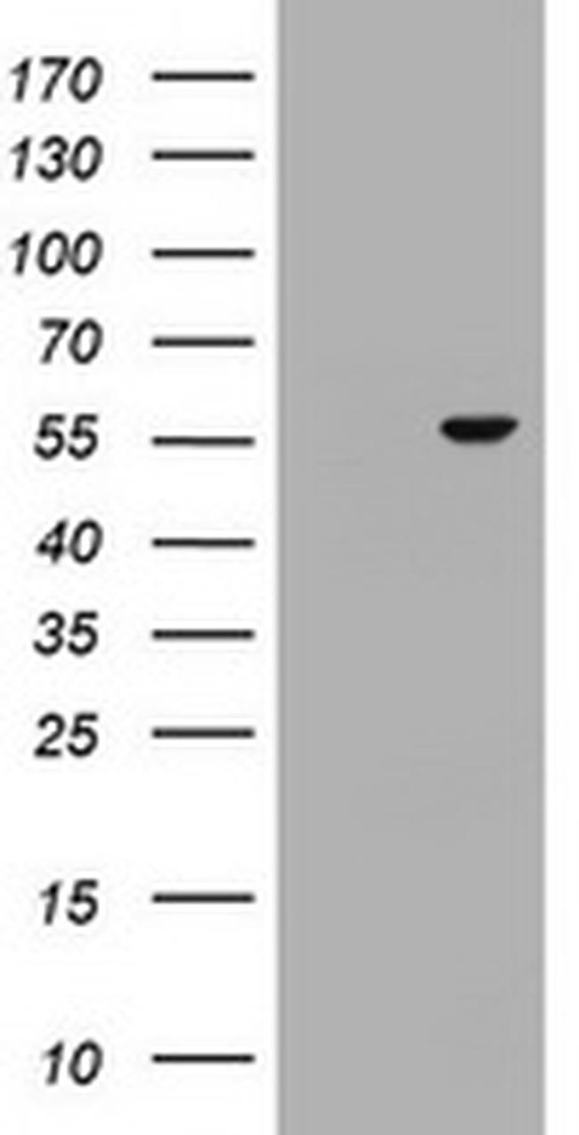 OSBPL2 Antibody in Western Blot (WB)