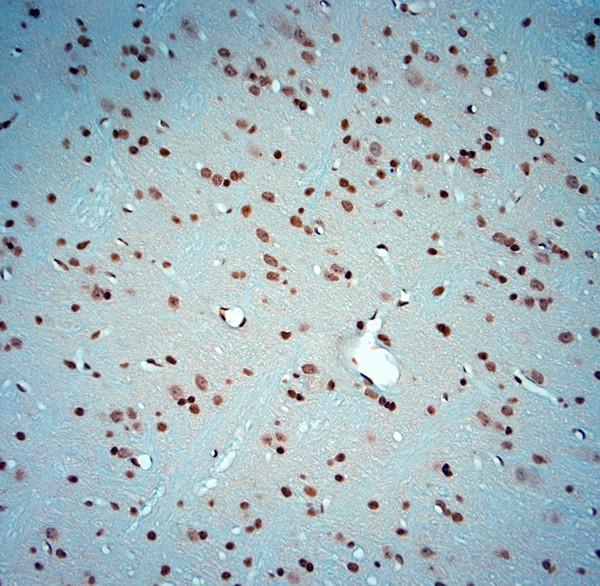 c Fos Antibody in Immunohistochemistry (Paraffin) (IHC (P))